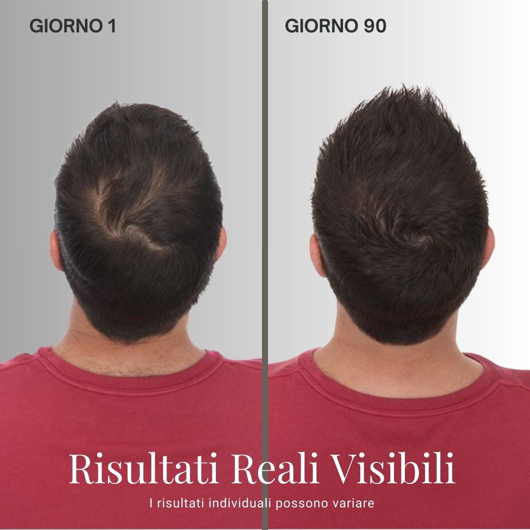 Kit 4 in 1 per ricrescita boost - Alopecia Androgenica (AGA)