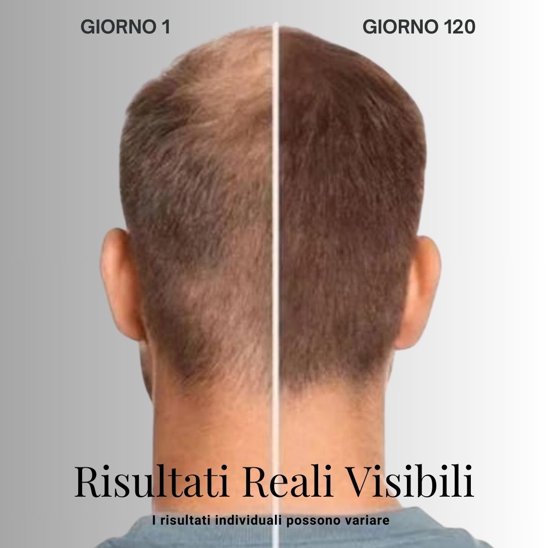 Kit 4 in 1 per ricrescita boost - Alopecia Androgenica (AGA)