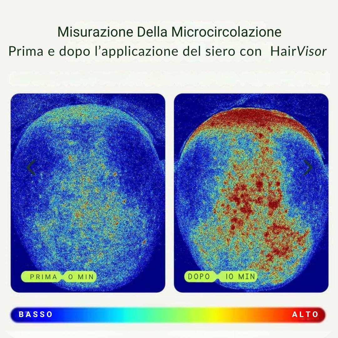 Kit 4 in 1 per ricrescita boost - Alopecia Androgenica (AGA)